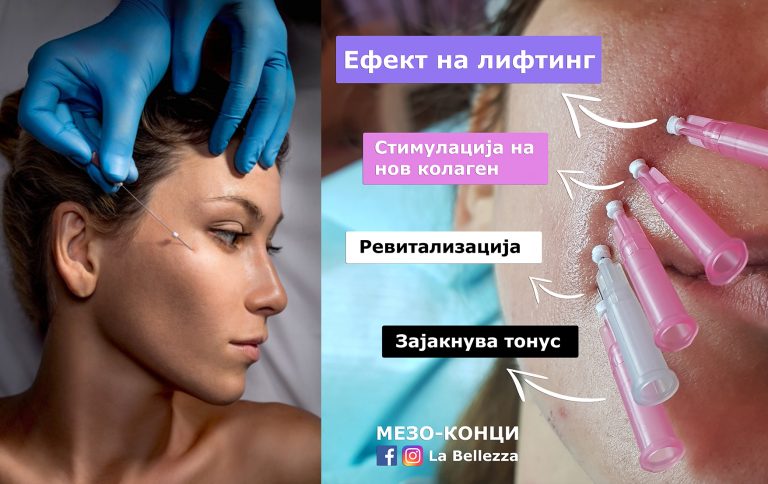 4D терапија со Мезо-конци [Ревитализација, регенерација, зацврствуање и појачување на тонусот]