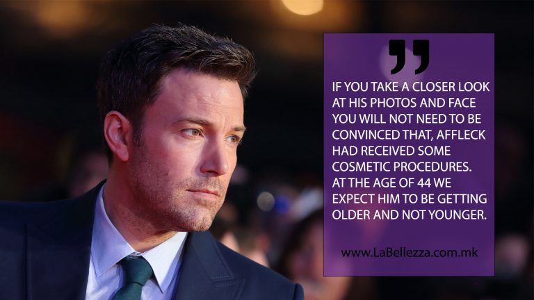 Ben Affleck – 2те процедури пред снимањето на филмот Batman vs Superman