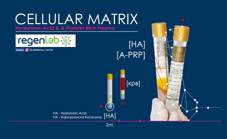 НАЈНОВО: Cellular Matrix, A-PRP & HA – RegenLab