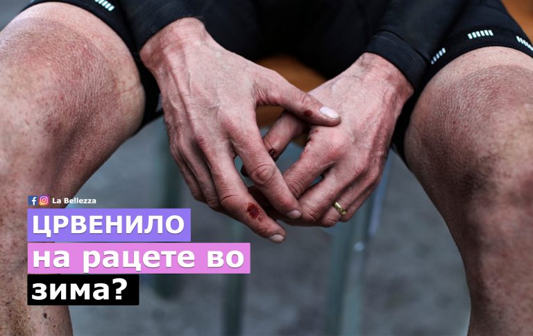 Превенција на црвенило на рацете