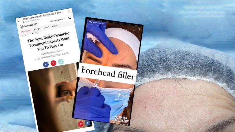 Refinery29: Глобалниот тренд на хијалуронски филер на чело