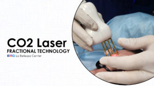 CO2 Fractional Laser