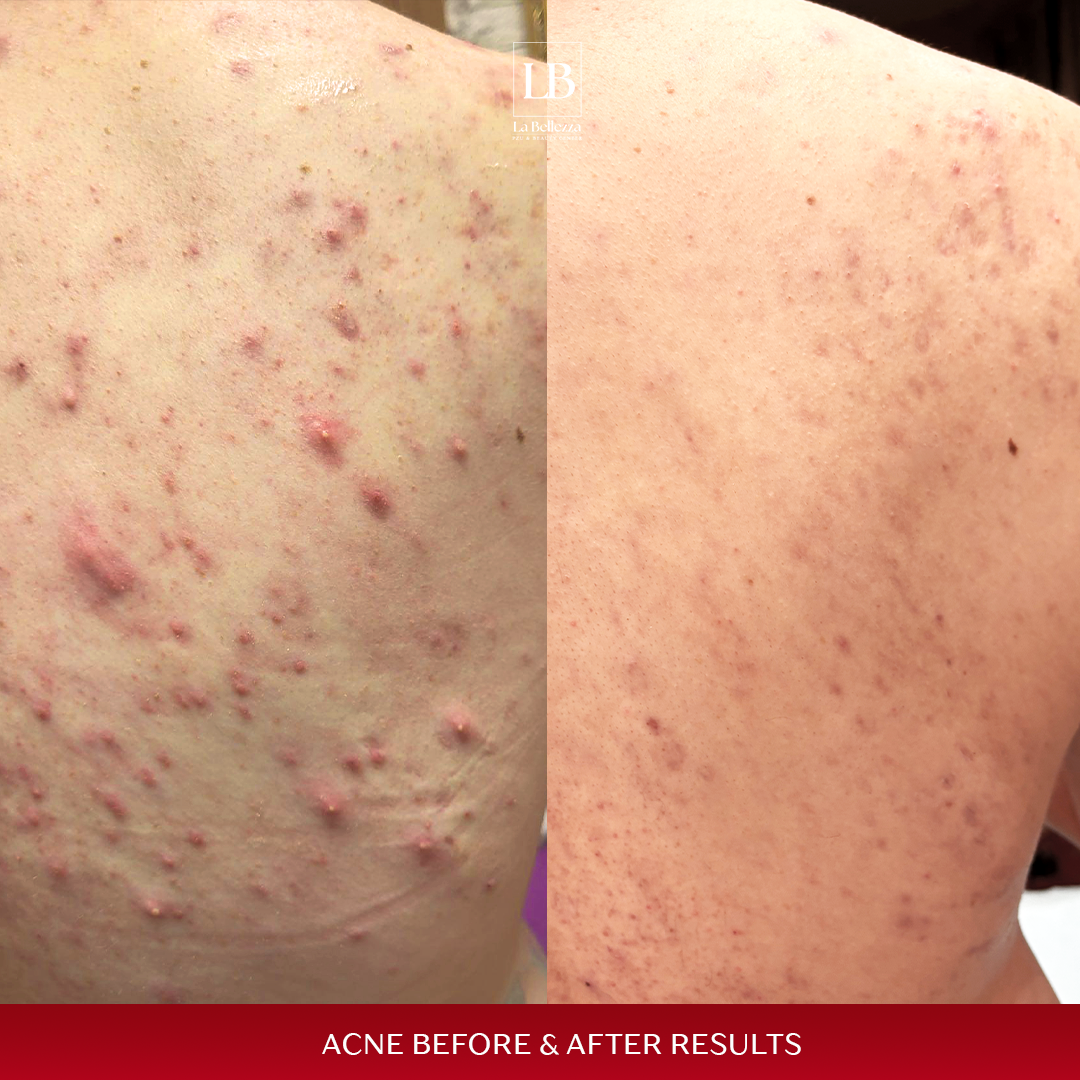 Akni b&a 1 copy